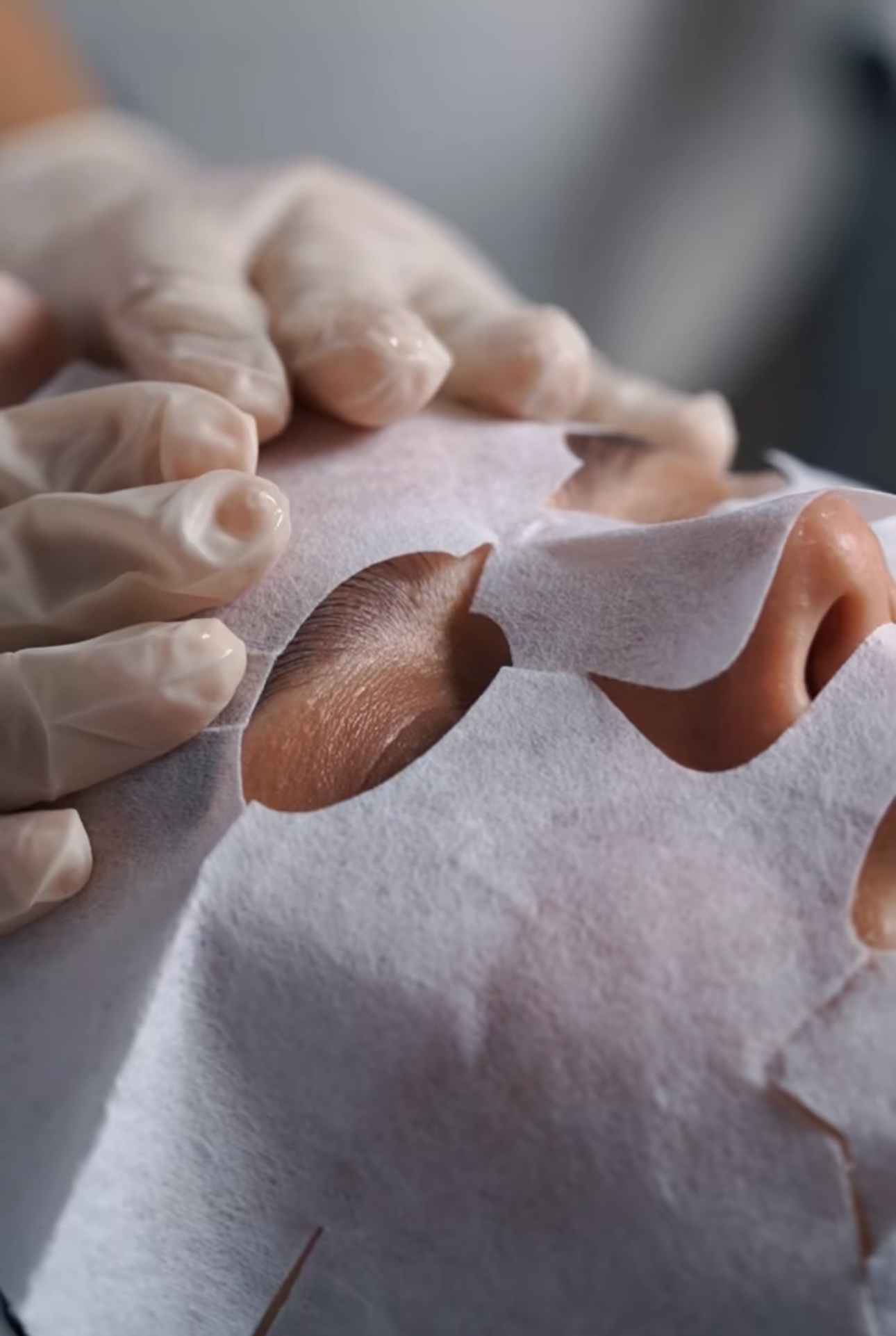 КАРБОКСИ ТЕРАПИЯ - Image 4