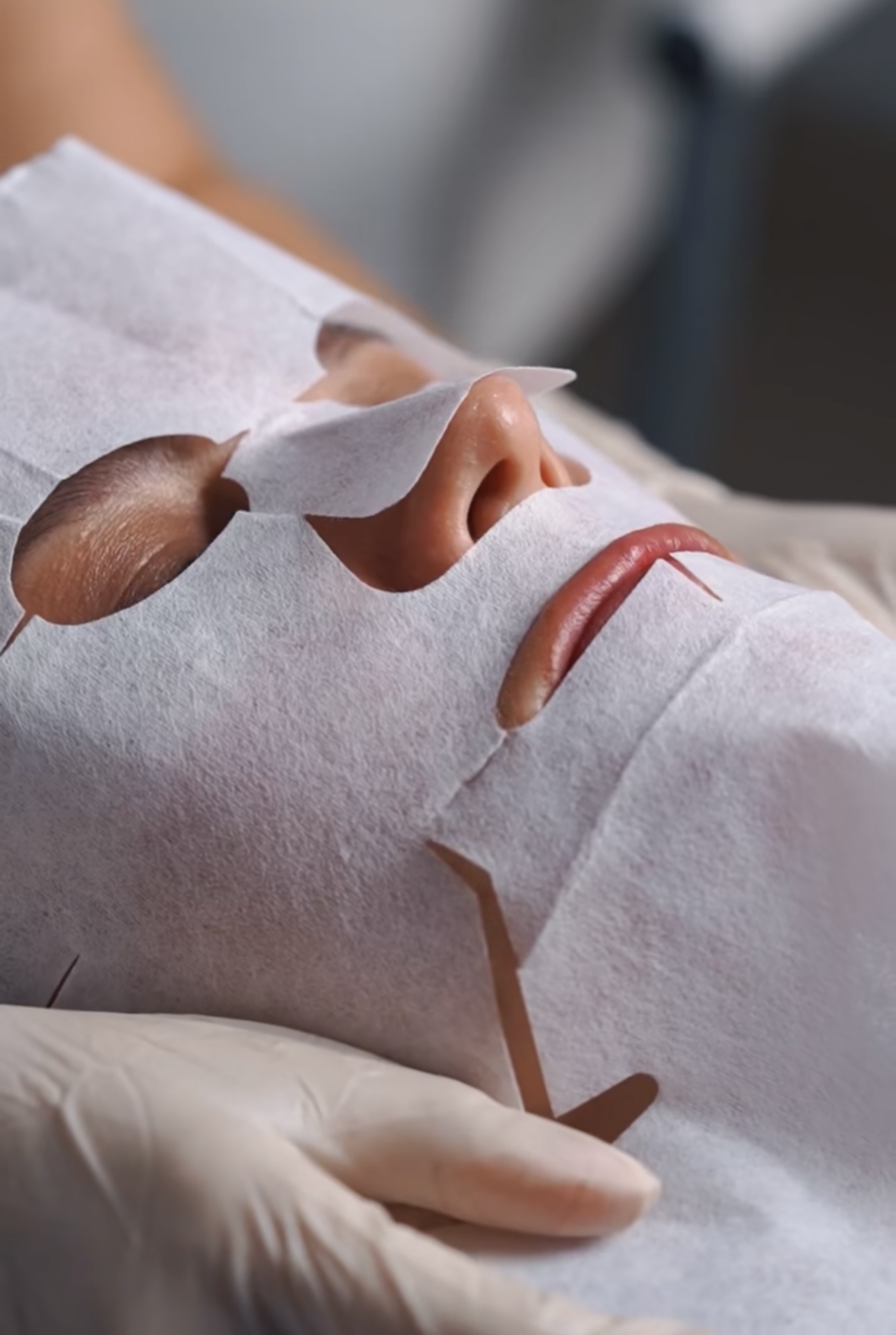 КАРБОКСИ ТЕРАПИЯ - Image 2