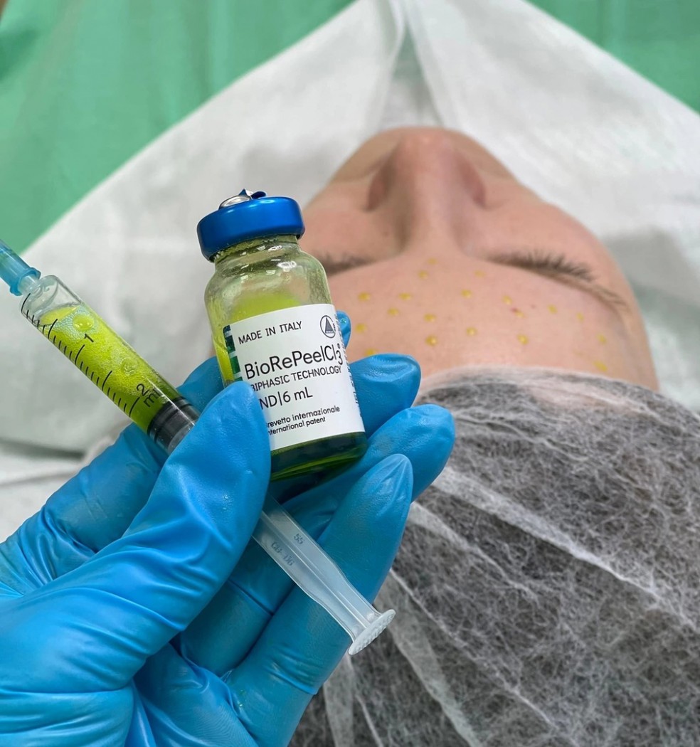 BIOREPEELCL – ДВУФАЗЕН ПИЛИНГ - Image 4