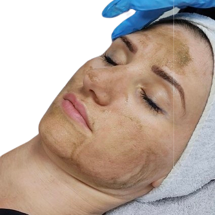 SQT БИОМИКРОНИДЛИНГ