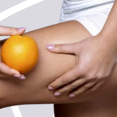 Accent Prime – радиочестота срещу целулит