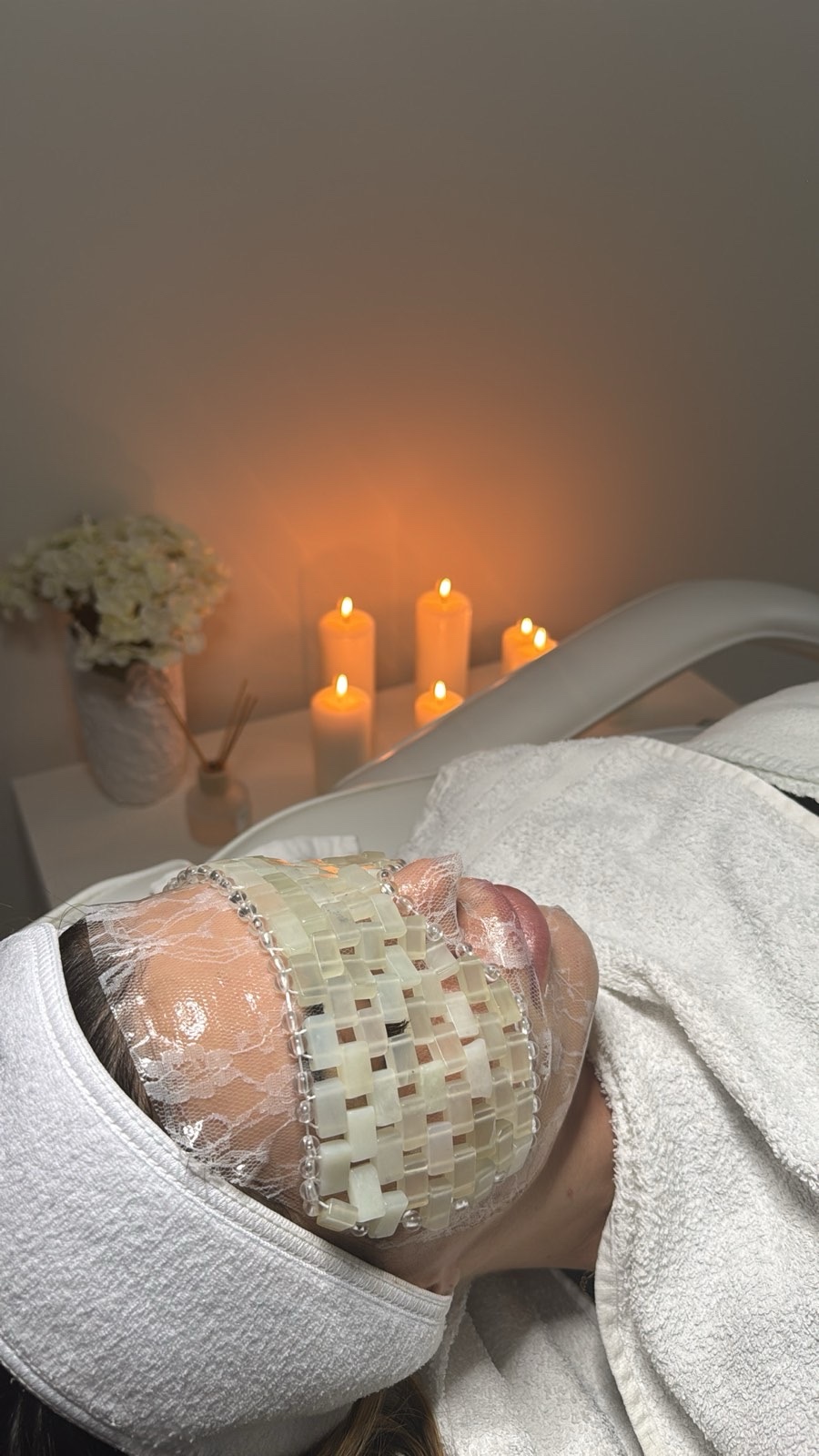 Кислородна мезотерапия - Image 2